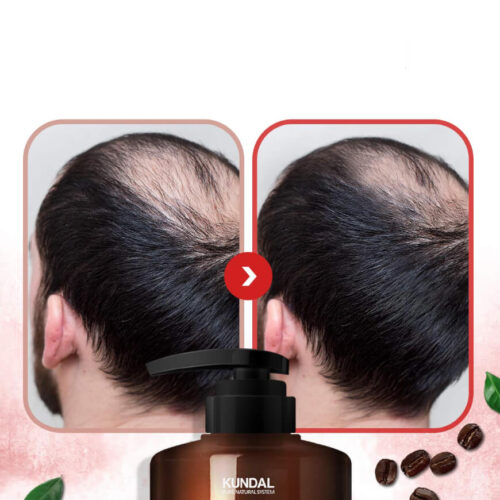 [Kundal] Shampoo Anticaida (3 Fragancias) - Imagen 3